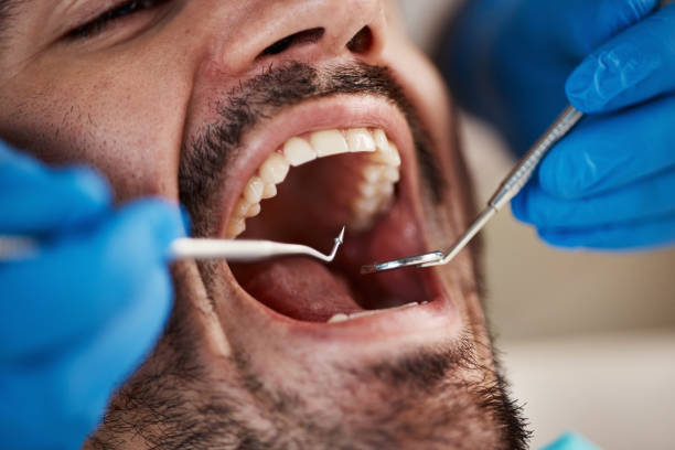 Best Emergency Root Canal Treatment in Westville, OK